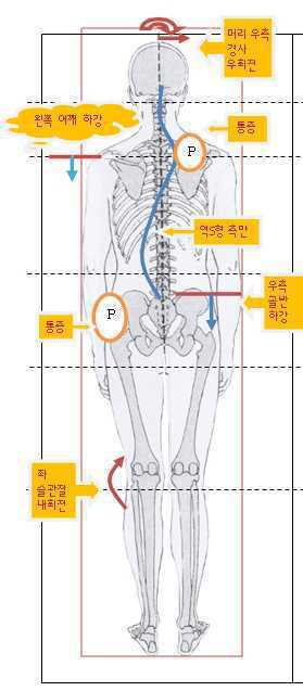 체형분석