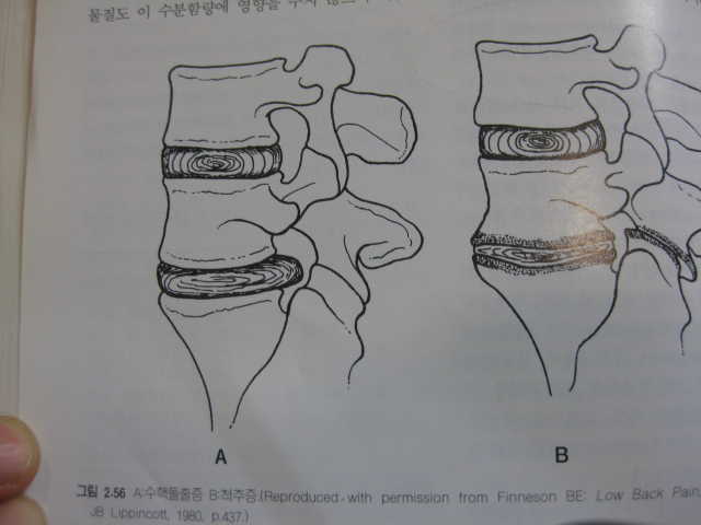 디스크 탈출