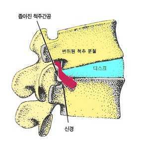 추나요법