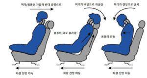 교통사고 후유증