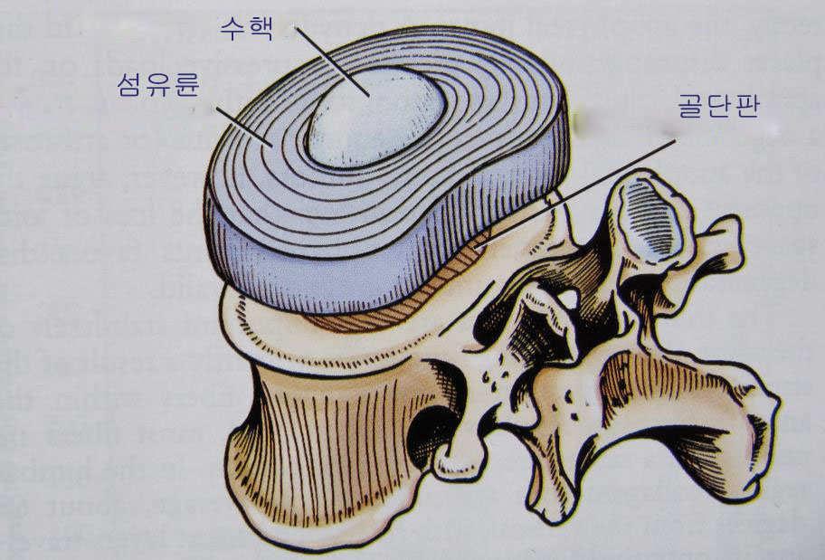 교통사고 후유증