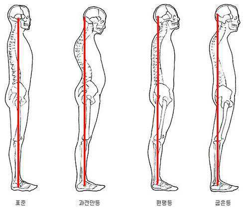 오십견이 많이 생기는 이유 3