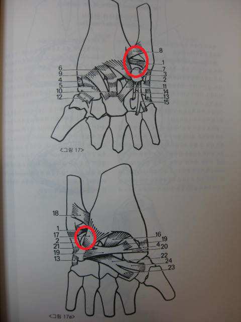손목이 아프면 수근관 증후군?